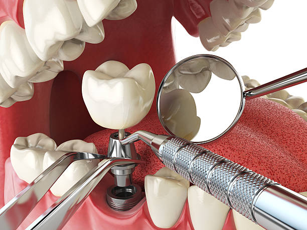 Best Urgent Tooth Repair  in Ottawa Hills, OH